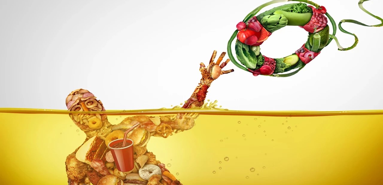 Hafifleme Adımları: Tüp Mide Ameliyatına Nasıl Hazırlık Yapılır?